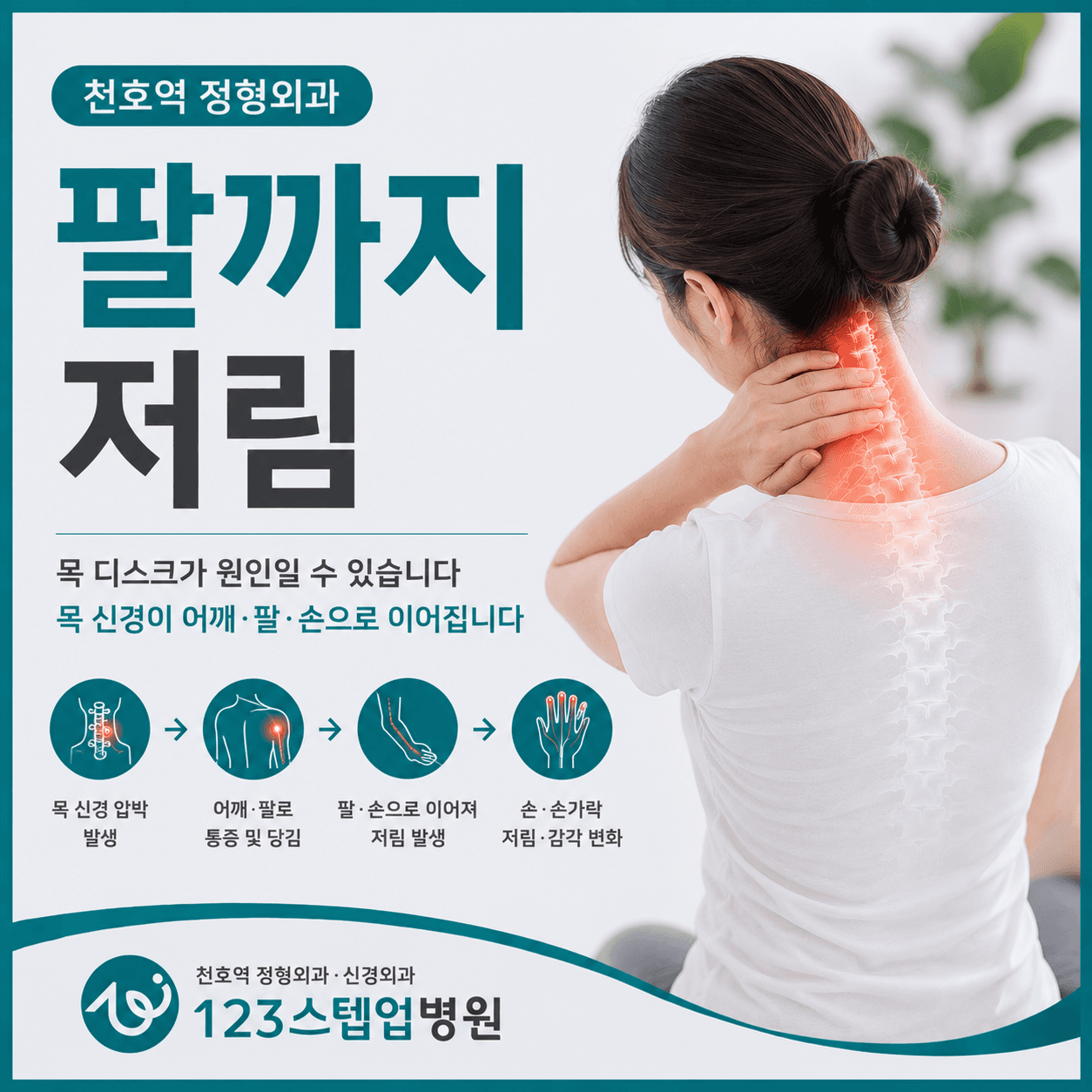 목은 조금 뻐근한데 팔과 손까지 저린 이유는?