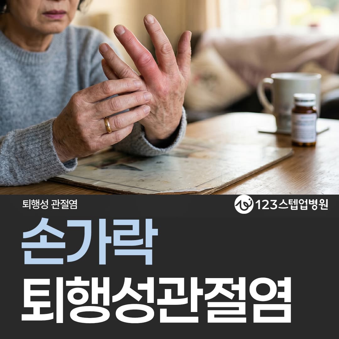 손가락 퇴행성관절염, 통증과 모양 변화가 다르게 나타나는 이유는?