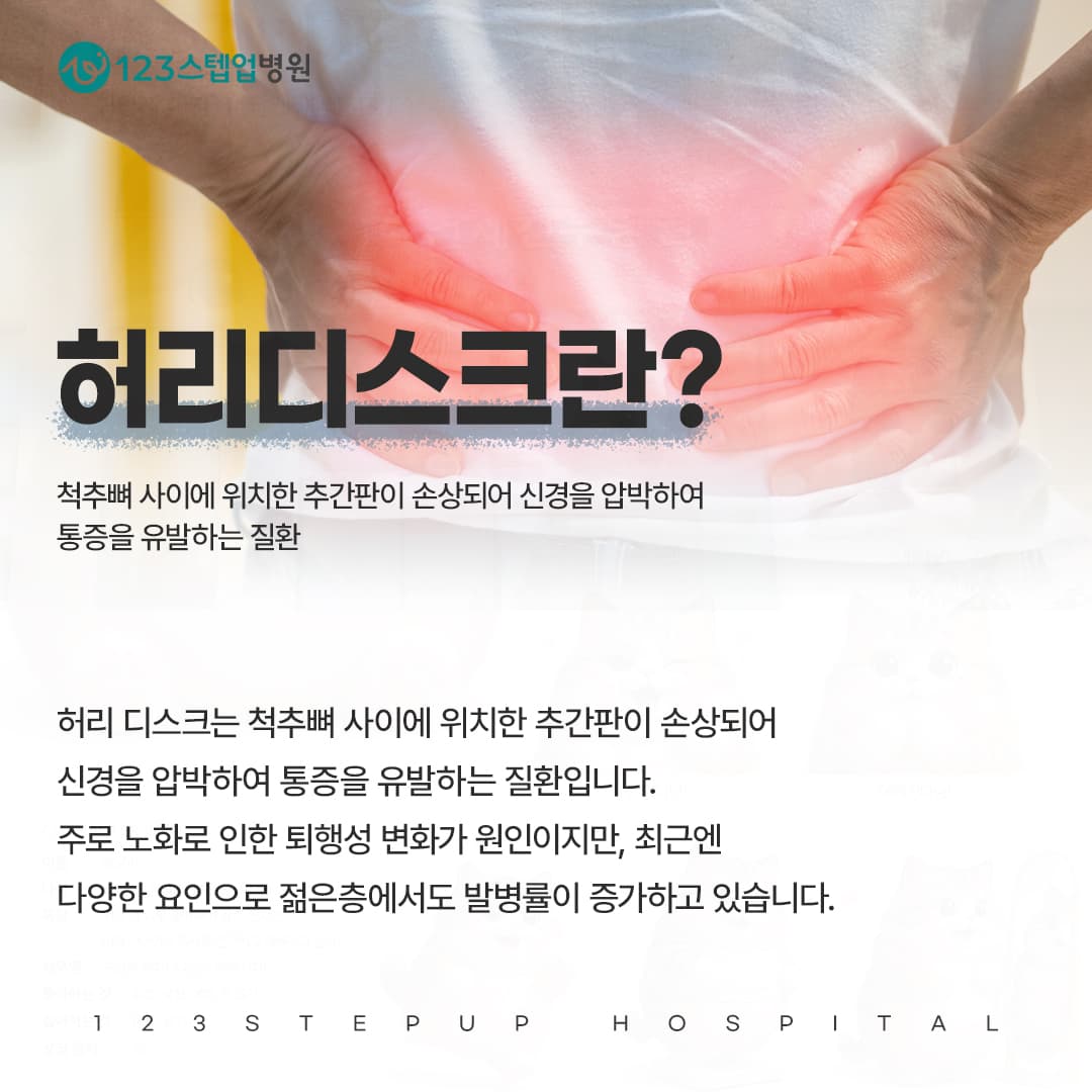 허리디스크는 MRI만으로 판단할 수 있을까요?