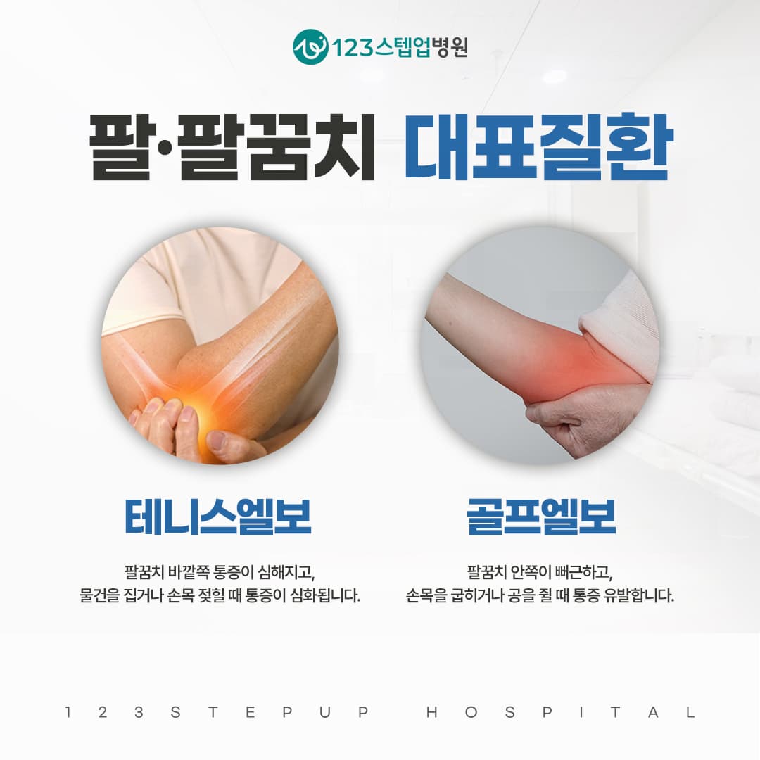 테니스엘보, 반복되는 팔꿈치 통증은 힘줄과 어떤 관련이 있을까요?