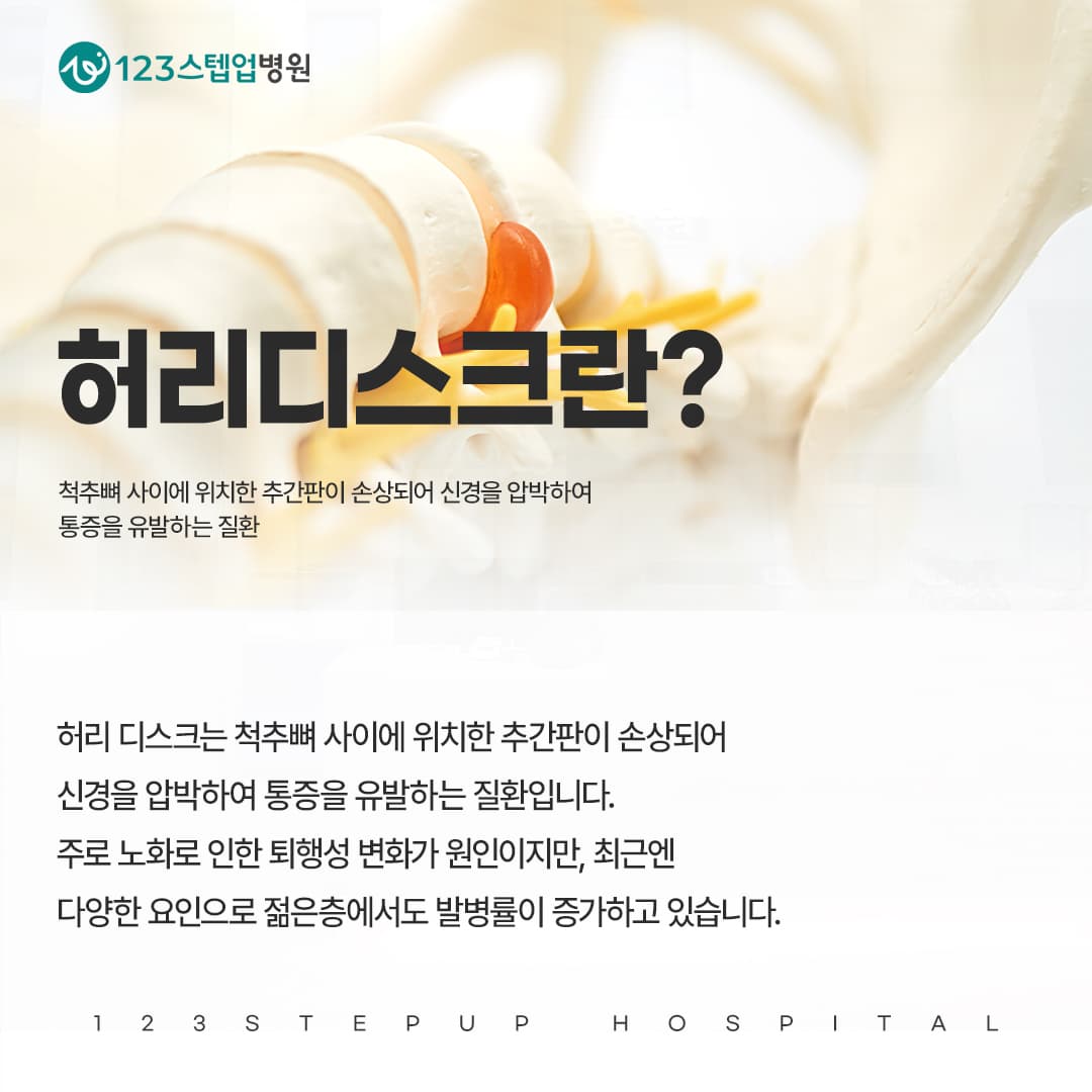 교통사고 직후 괜찮다가 며칠 뒤 허리가 아픈 이유는?