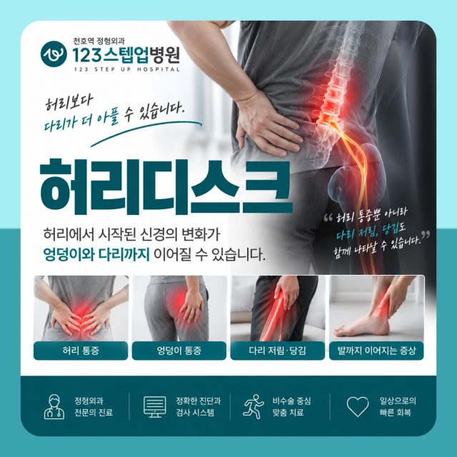 천호 정형외과 허리디스크 증상 유형은? 123스텝업병원